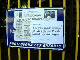 Imptigo  l'cole